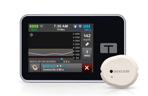 dexcom g7 integration with insulin pump